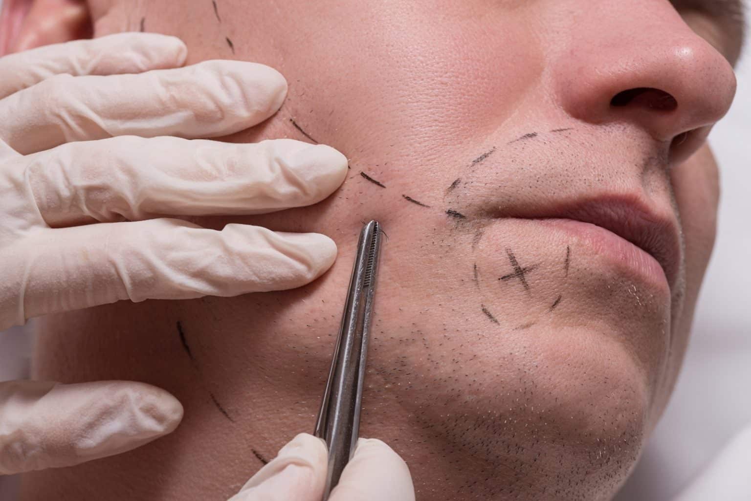 Kein Bartwuchs Wie das Problem angehen? Heisenbeard Kein Bartwuchs Wie das Problem angehen? Heisenbeard
