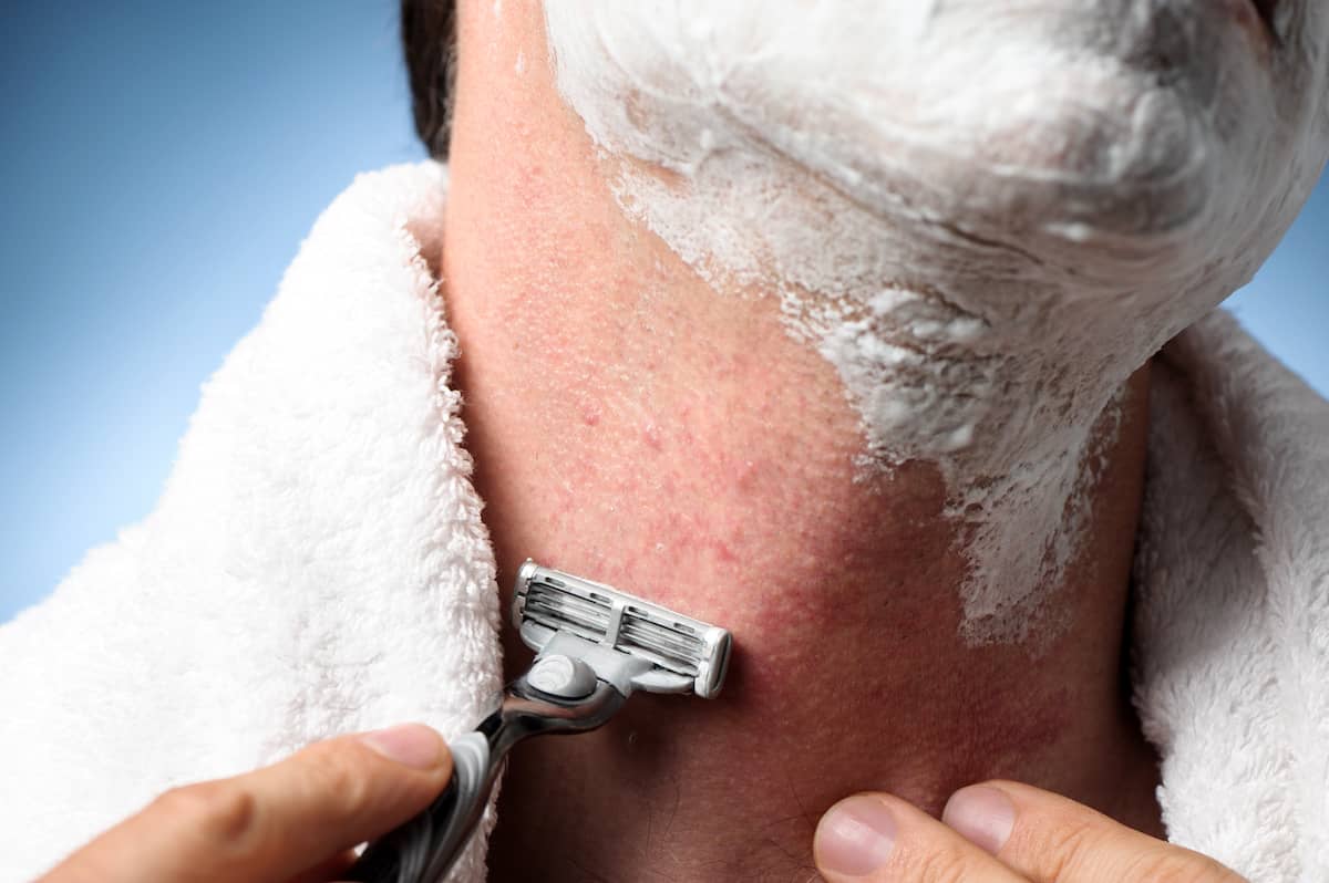 Bart juckt wegen Rasurbrand: Mann fasst sich beim Rasieren an den Hals