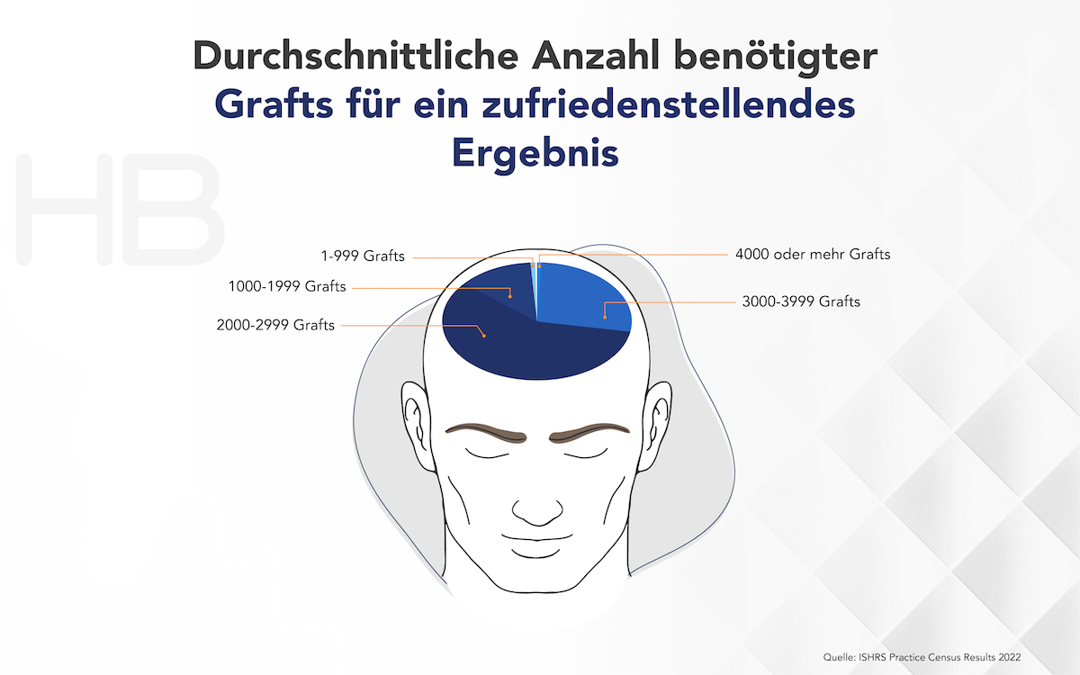 Haartransplantation Türkei wie viele Grafts für zufriedenstellendes Ergebnis Infografik