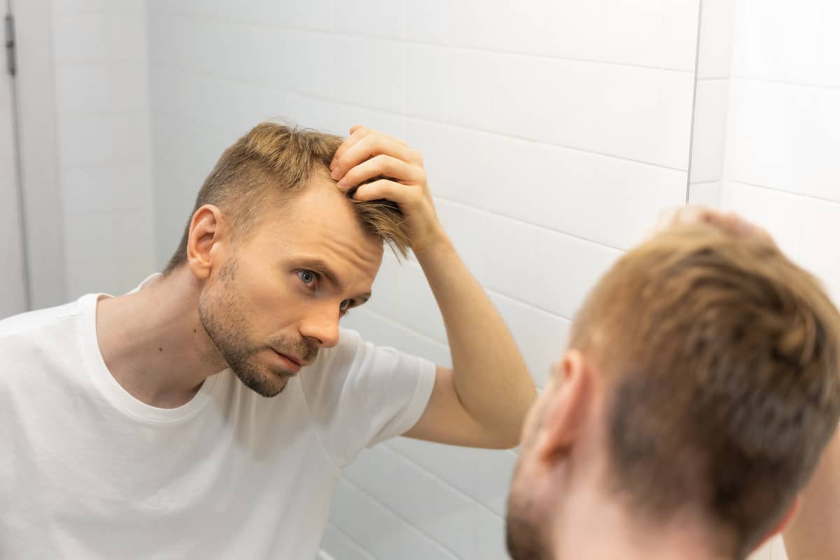 Mann sieht dünner werdendes Haar im Spiegel und denkt über eine Haartransplantation in der Türkei nach