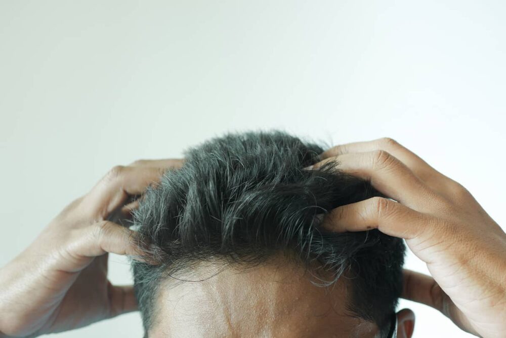 Plötzlich Schwarze Haare Auf Dem Kopf heisenbeard.de