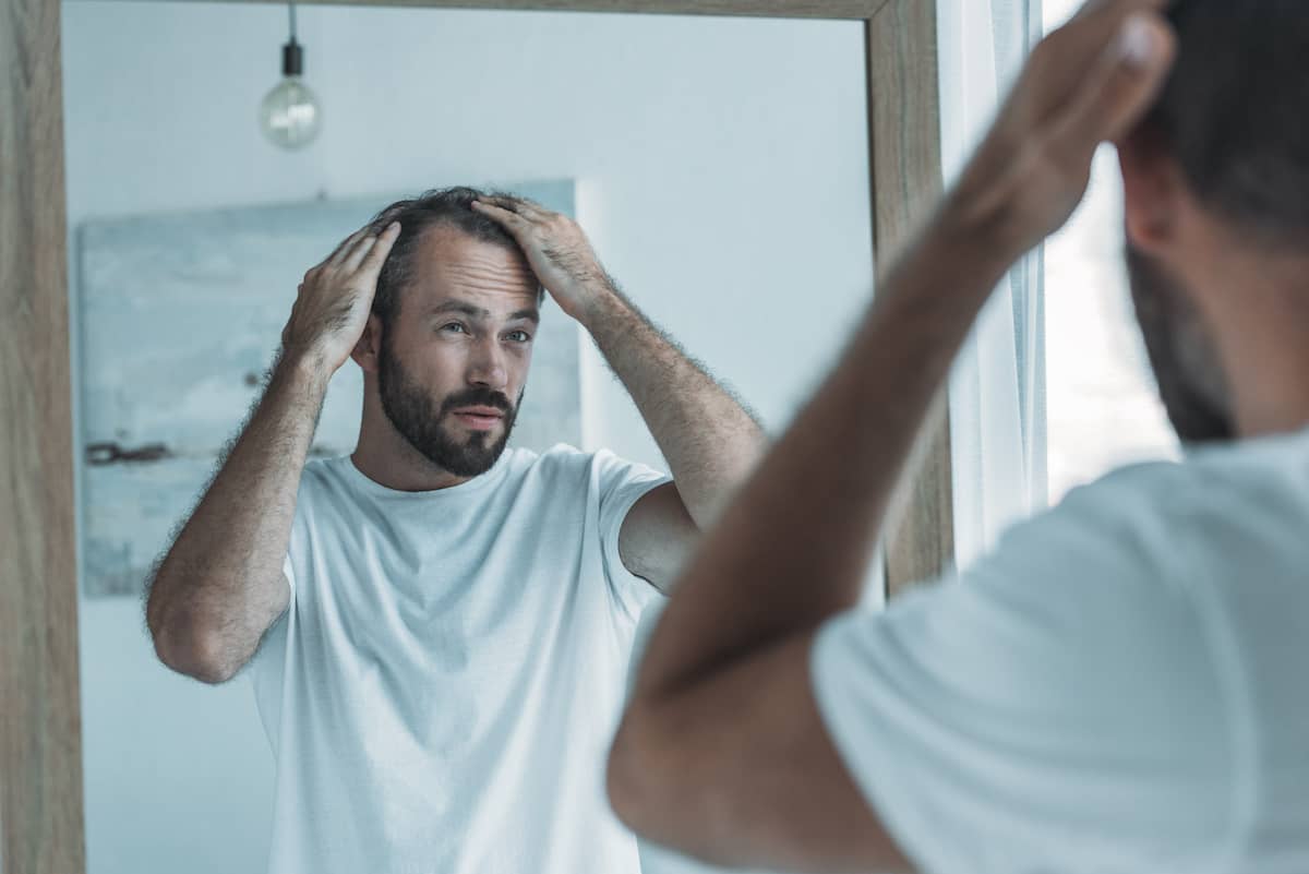 Mann begutachtet seinen erblich bedingten Haarausfall im Spiegel