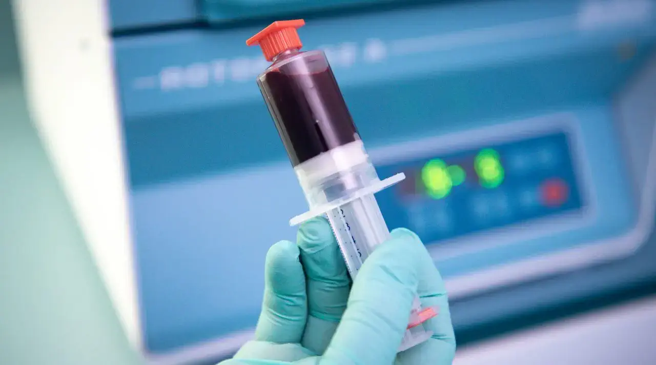 Blutrohr gefüllt mit Blut für PRP-Behandlung 