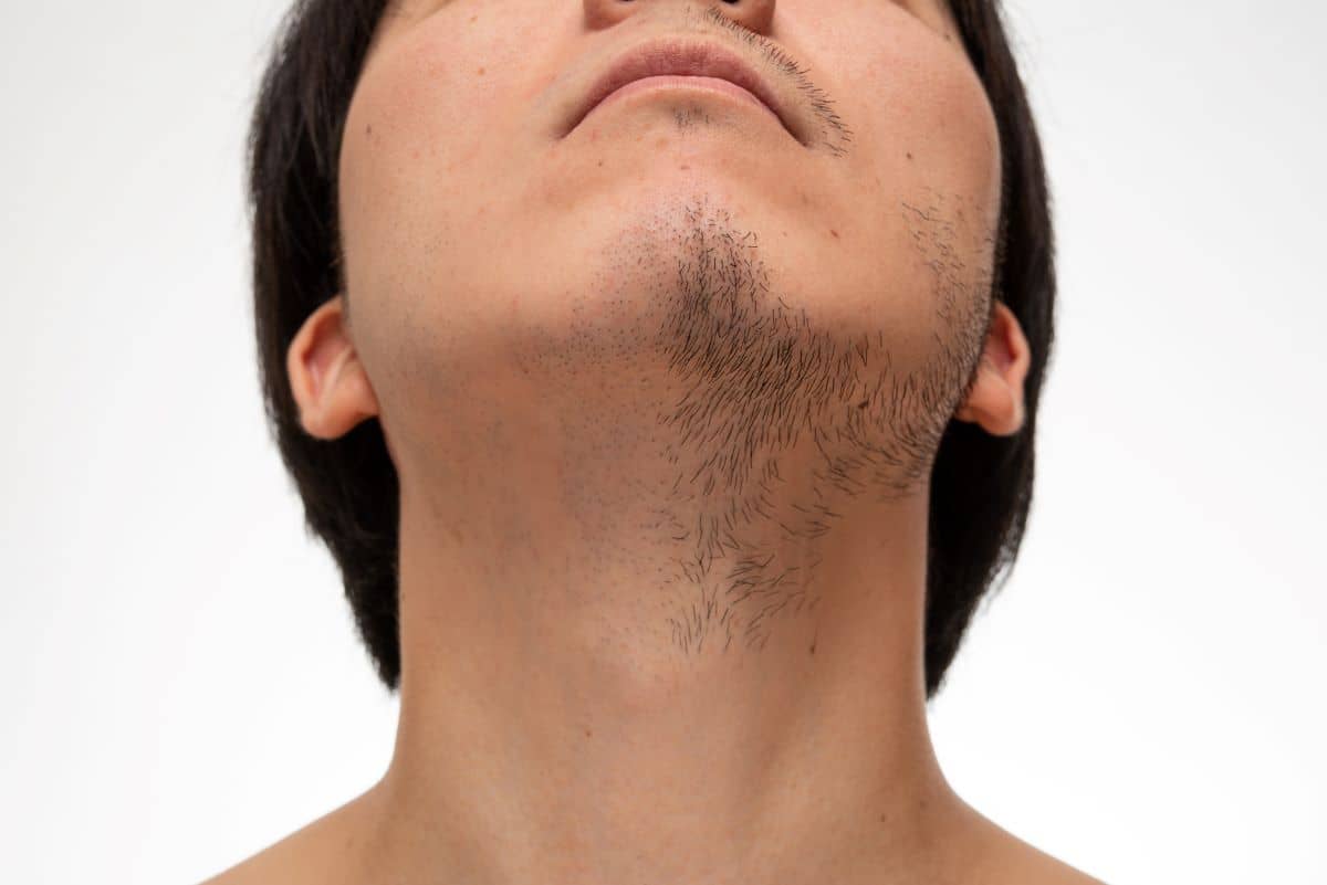 Mann mit schwachem und lückenhaftem Bartwuchs
